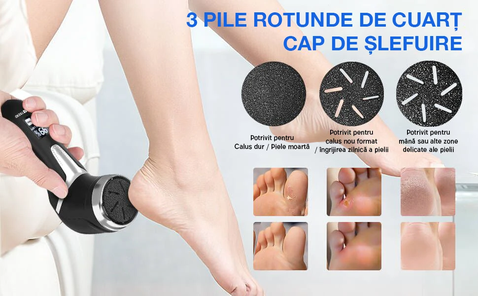 pila calcaie electrica imatrend aspirare reziduuri